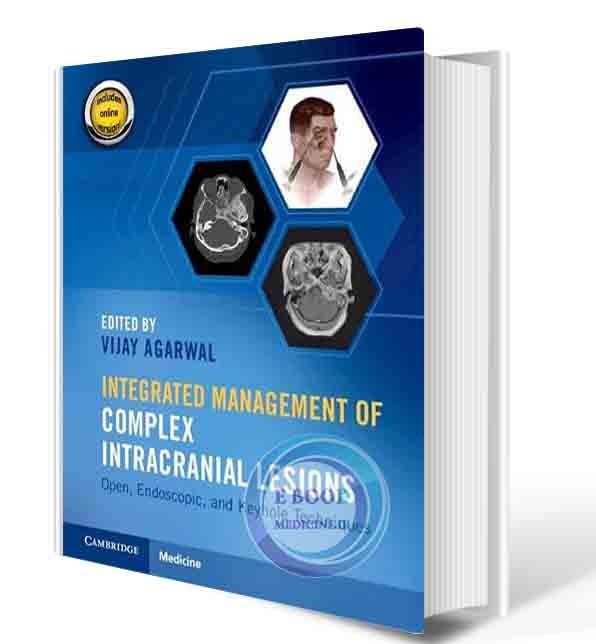 دانلود کتابIntegrated Management of Complex Intracranial Lesions Hardback Set and Static Online Product: Open, Endoscopic, and Keyhole Techniques New Edition 2022( PDF)